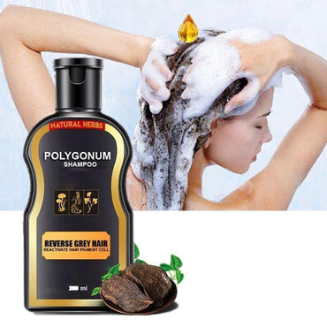 Hair Loss Treatment Shampoo for Men & Women - Natural & Organic Hair Regrowth