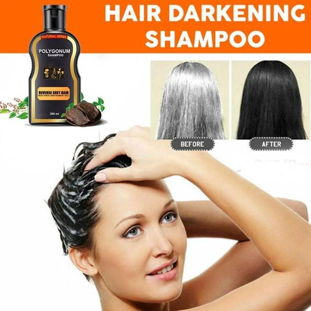 Hair Loss Treatment Shampoo for Men & Women - Natural & Organic Hair Regrowth